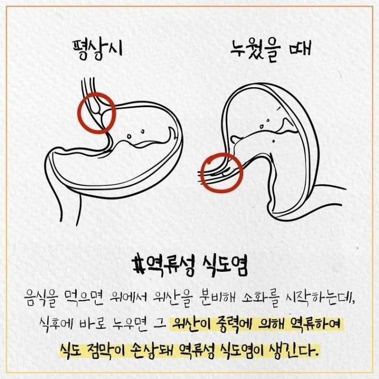 밥먹고 바로 누우면 안되는 이유